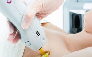 اسم انواع دستگاه لیزر + معرفی بهترین دستگاه لیزر موهای زائد 2019 candela laser hair removal 825x510 1 300x185 - اسم انواع دستگاه لیزر + معرفی بهترین دستگاه لیزر موهای زائد 2019