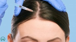 مزوتراپی مو چیست | هزینه مزوتراپی مو در بهترین مرکز چقدر است؟ meditravelist mesotheraphy for hair 300x168 - مزوتراپی مو چیست | هزینه مزوتراپی مو در بهترین مرکز چقدر است؟