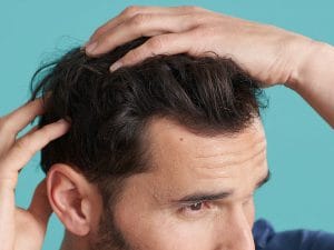 ریزش مو شدید دارم چیکار کنم | بهترین درمان ریزش مو مردان و زنان 0 ReachHLIMG3 300x225 - ریزش مو شدید دارم چیکار کنم | بهترین درمان ریزش مو مردان و زنان