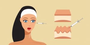 مهمترین نکات درباره مزوتراپی که متخصصان زیبایی هرگز به شما نمی گویند!!! hyaluronic acid facial injection skin layer beauty cosmetology anti aging female rejuvenating mesotherapy concept portrait horizontal 48369 24777 300x150 - مهمترین نکات درباره مزوتراپی که متخصصان زیبایی هرگز به شما نمی گویند!!!