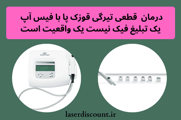 رفع تیرگی قوزک پا در یک هفته | درمان قطعی سیاهی قوزک پا قطعی تیرگی قوزک پا - رفع تیرگی قوزک پا در یک هفته | درمان قطعی سیاهی قوزک پا
