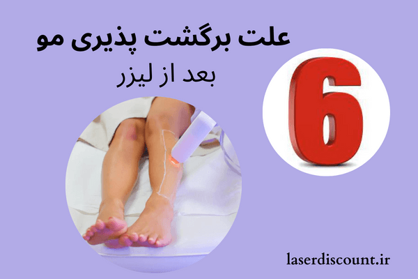 علت برگشت پذیری مو بعد لیزر