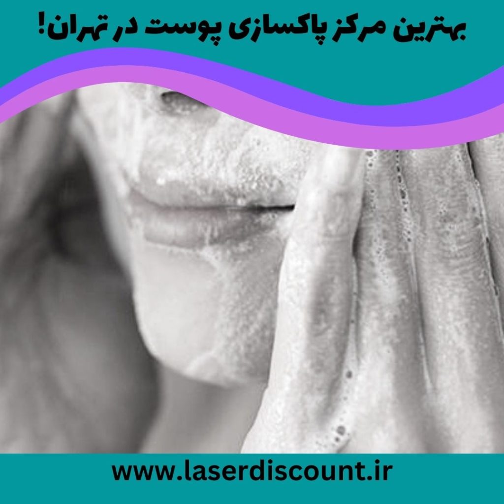 پاکسازی صورت در تهران