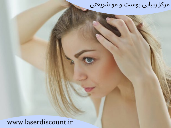 درمان سریع ریزش مو با مزوتراپی