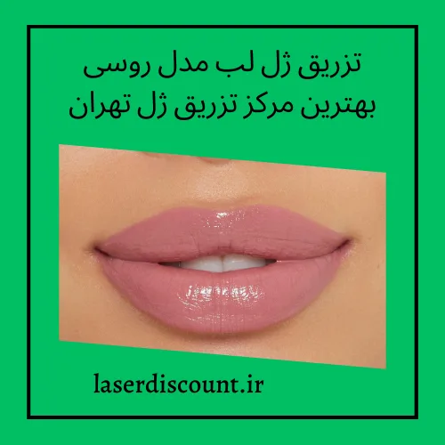 تزریق ژل لب مدل روسی