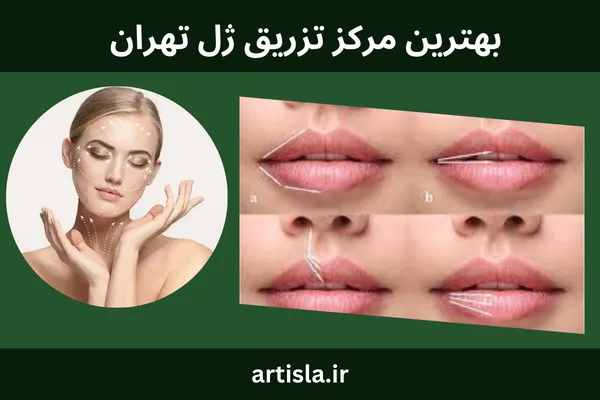 بهترین مرکز تزریق ژل در تهران